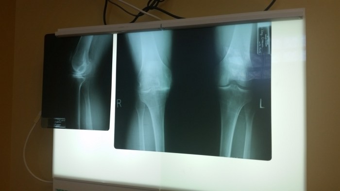 20151112_144932 - Copy